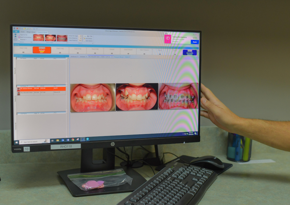 Orthodontist showing a young patient his orthodontic results photos with assistants nearby.